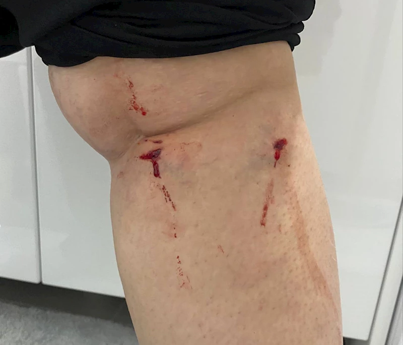 İstanbul - Üniversite kampüsünde köpeklerin saldırısına uğradı: O anlar kamerada / Ek fotoğrafla 