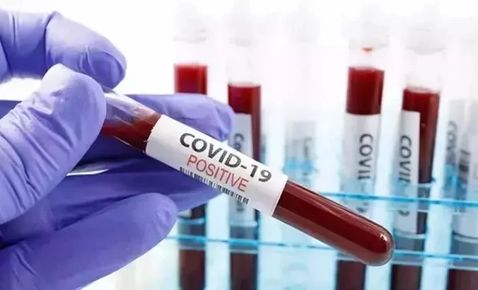 ABD’de her hafta 300’den fazla kişi Covid-19 nedeniyle hayatını kaybediyor